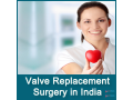 best-mitral-valve-repair-surgeon-in-india-small-0